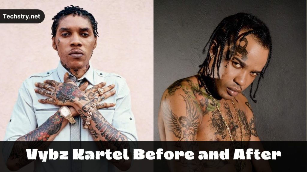 vybz kartel vorher und nachher