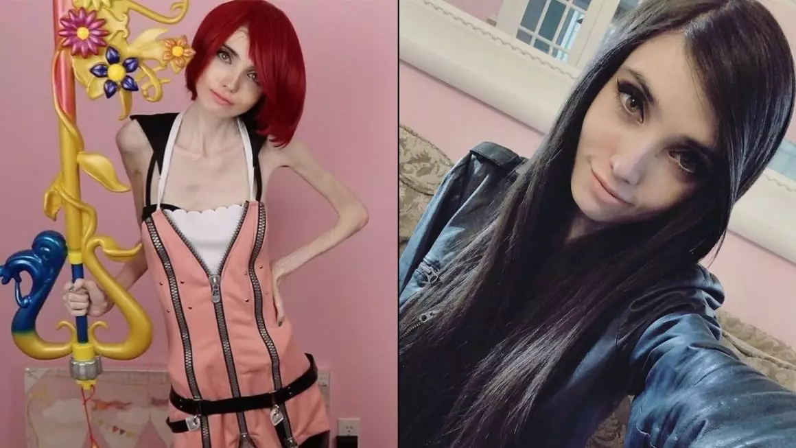 Eugenia Cooney Before and After