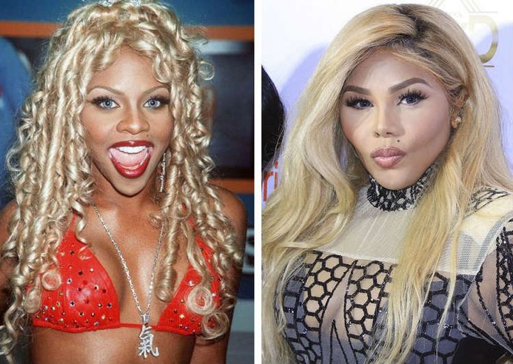 lil kim before surgery