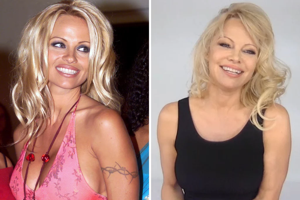 pam anderson before surgery