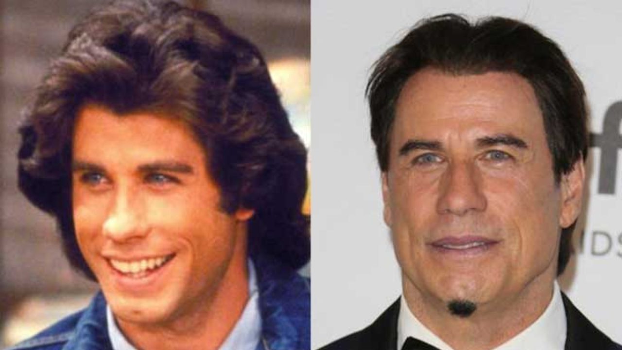 john travolta plastic surgery