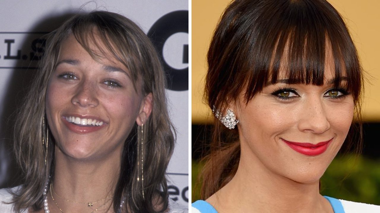 rashida jones plastic surgery