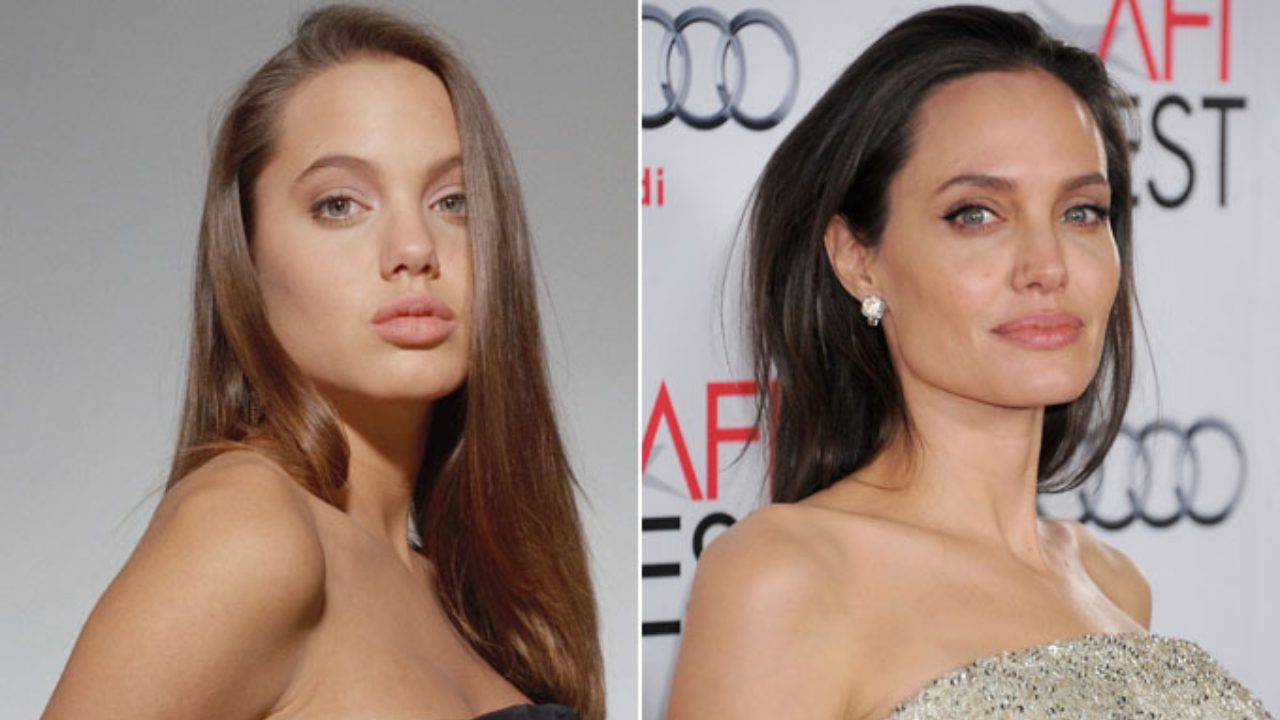 angelina jolie plastic surgery