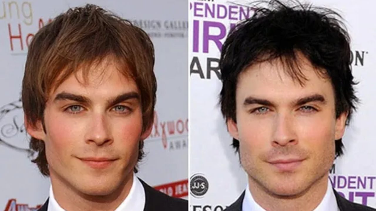 ian somerhalder before and after surgery