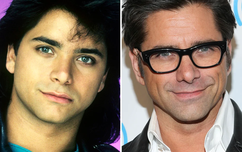 john stamos plastic surgery