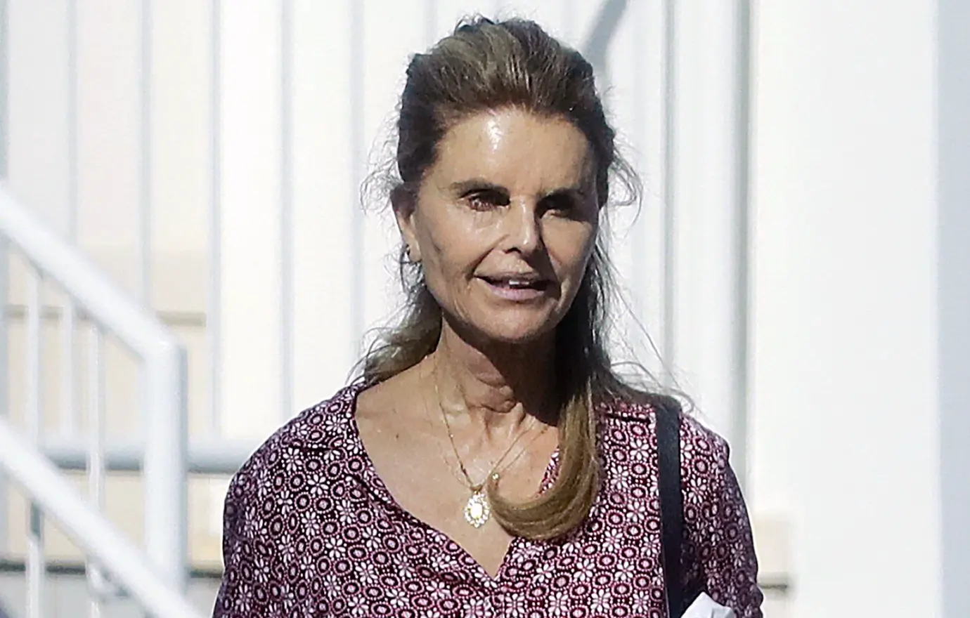 maria shriver plastic surgery