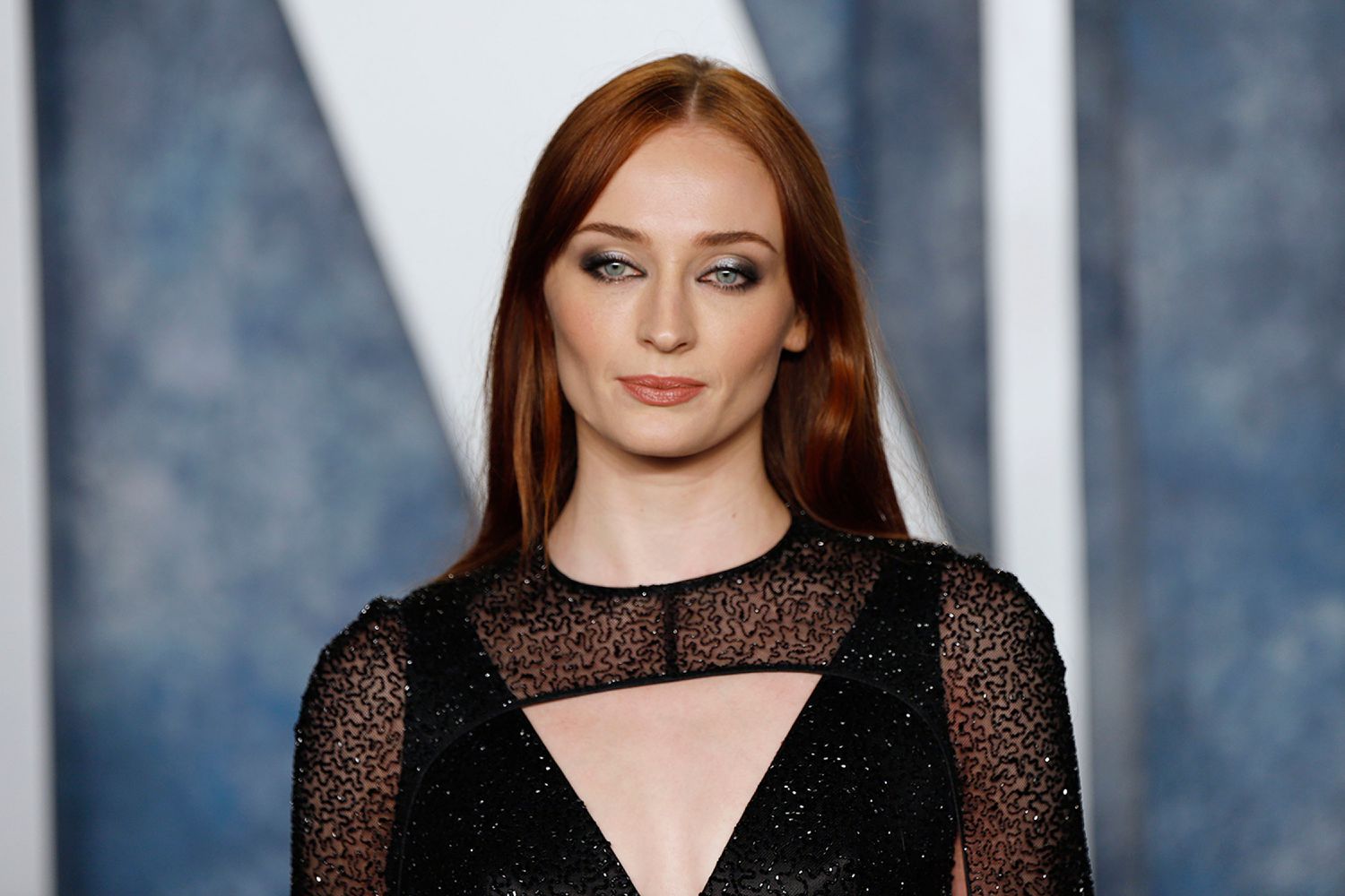 Did Sophie Turner Undergo Plastic Surgery? Unveiling the Secrets Behind