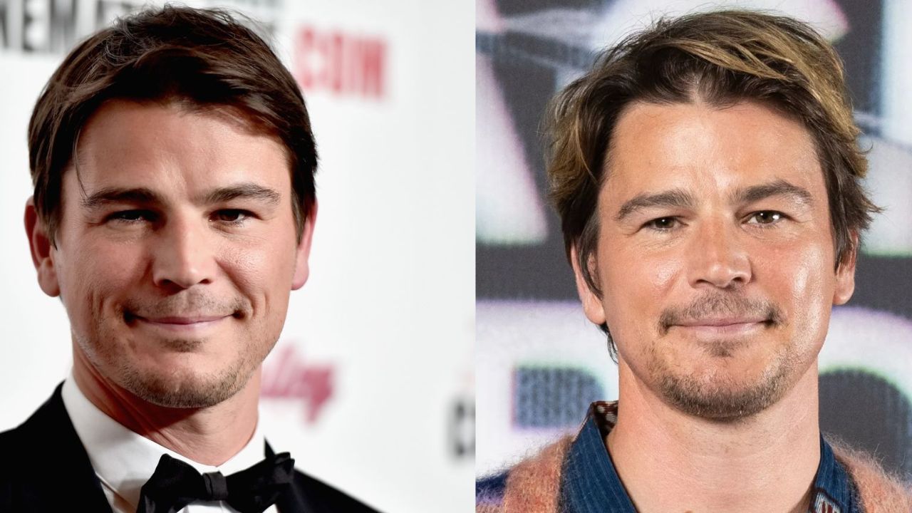 josh hartnett plastic surgery