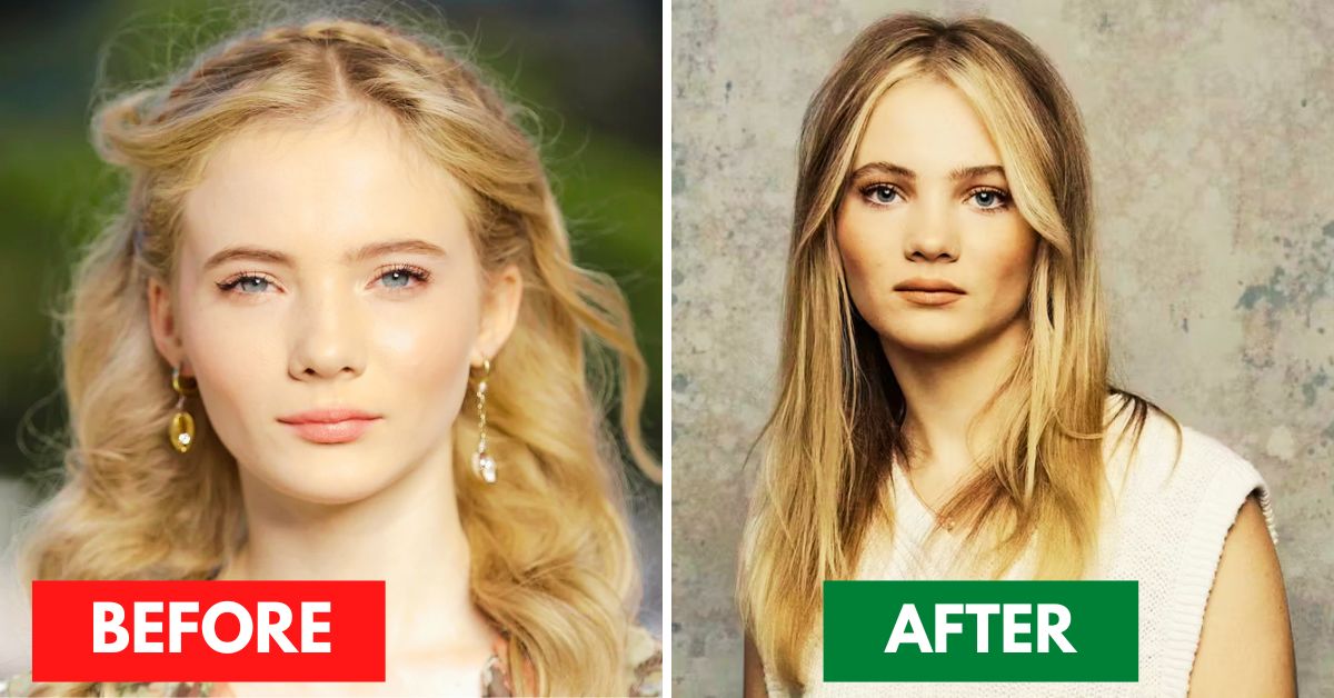 freya allan plastic surgery