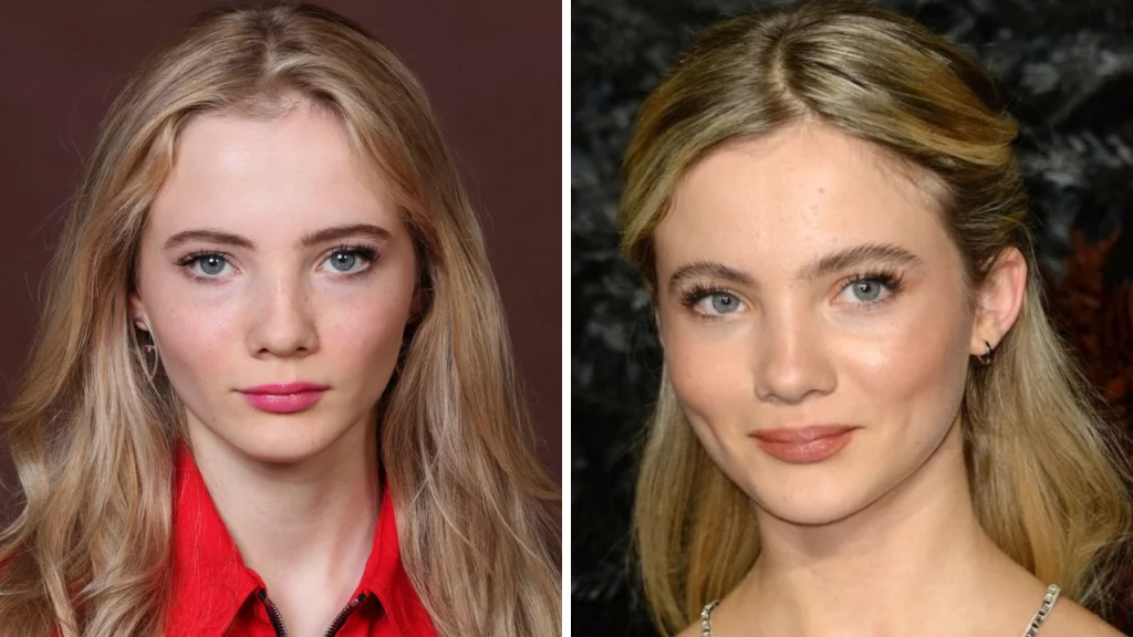 freya allan plastic surgery