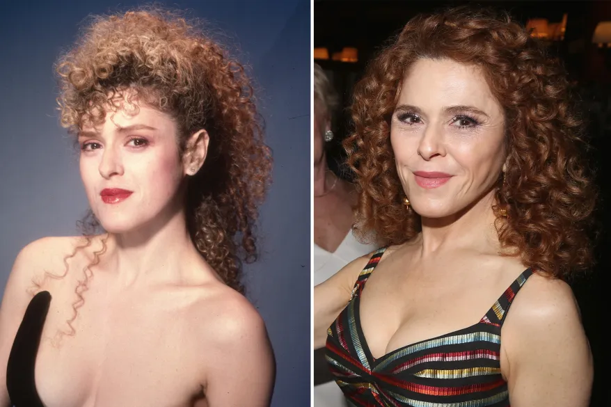 bernadette peters plastic surgery