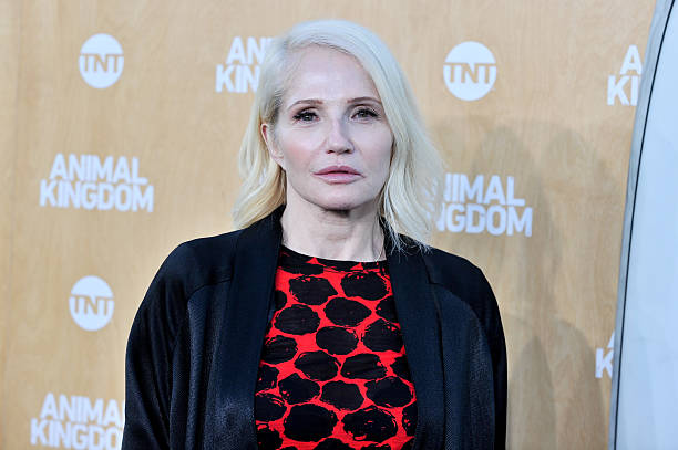 Ellen Barkin's Plastic Surgery