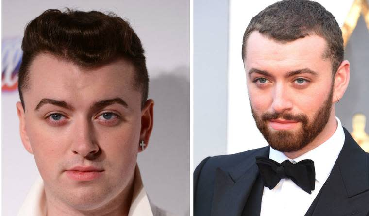 Sam Smith Before and After