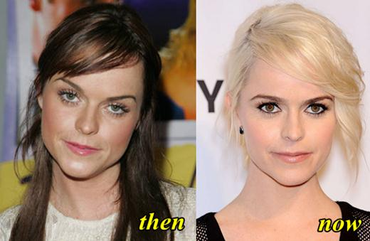 Taryn Manning Plastic Surgery