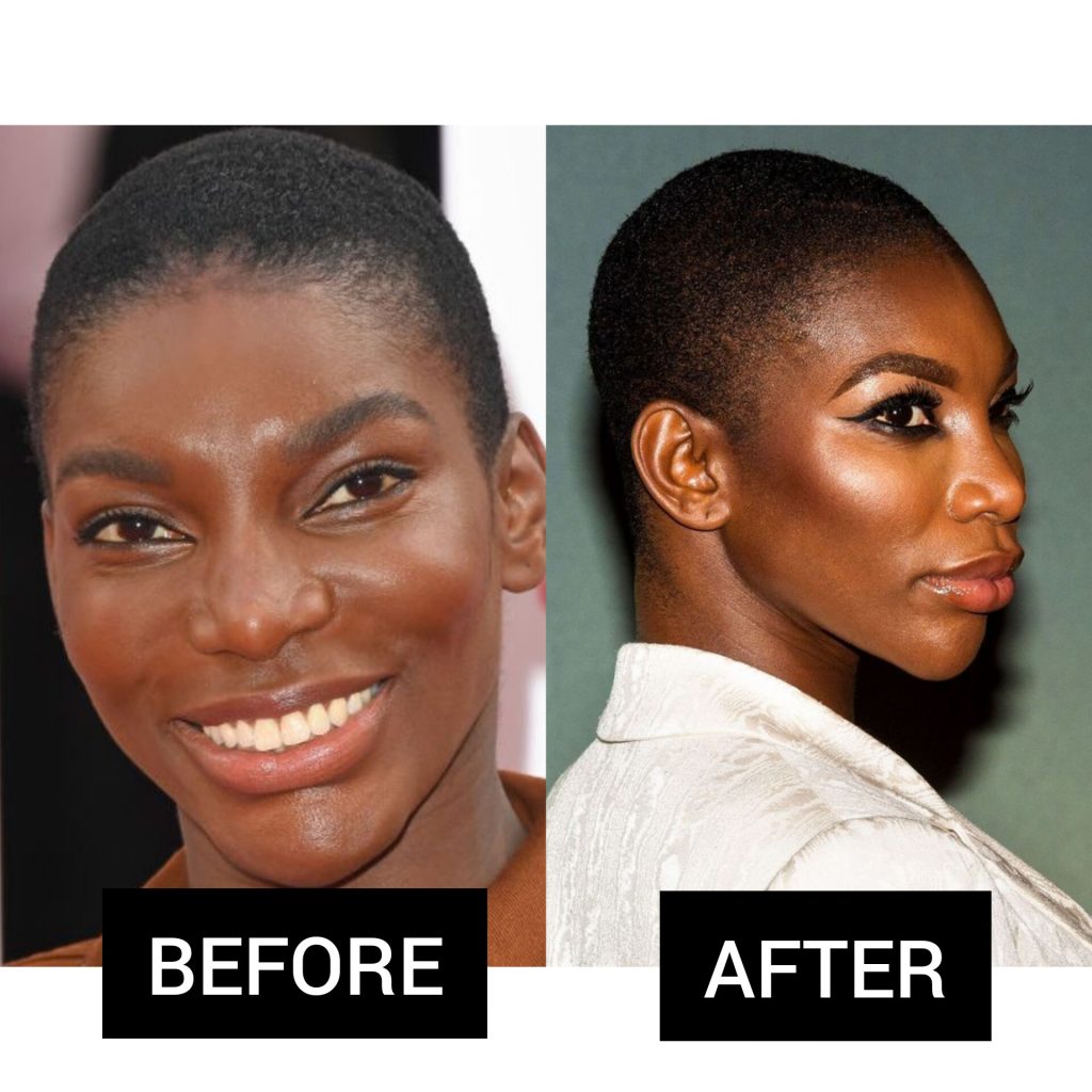 Michaela Coel Plastic Surgery